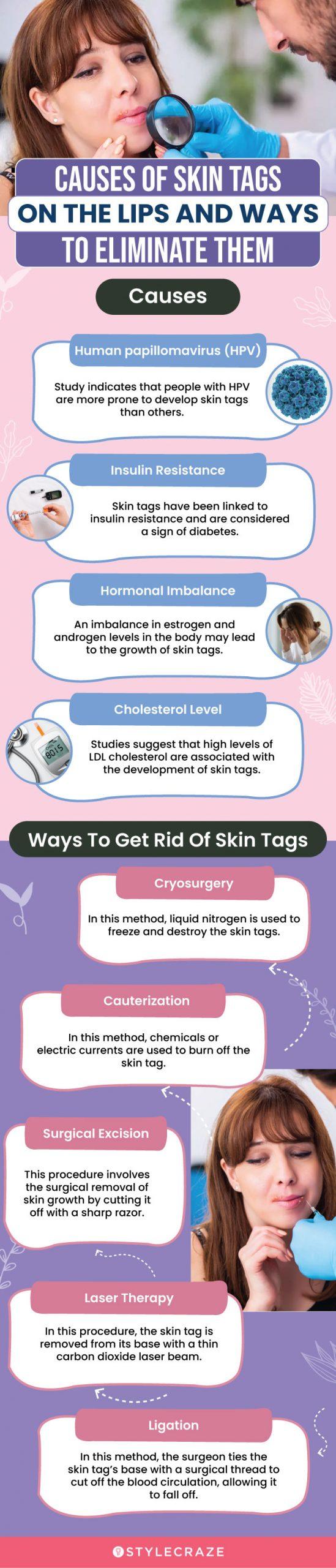 7 Essential Oils For Skin Tags - How To Use And Side Effects