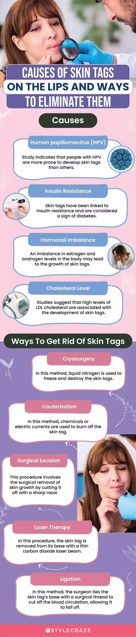 causes of skin tags on the lips and ways to eliminate them (infographic)