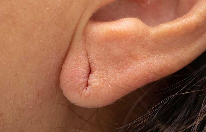 It-Could-Make-Your-Earlobes-Sag