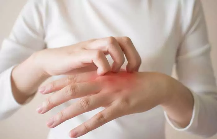 It-Might-Cause-Skin-Irritation