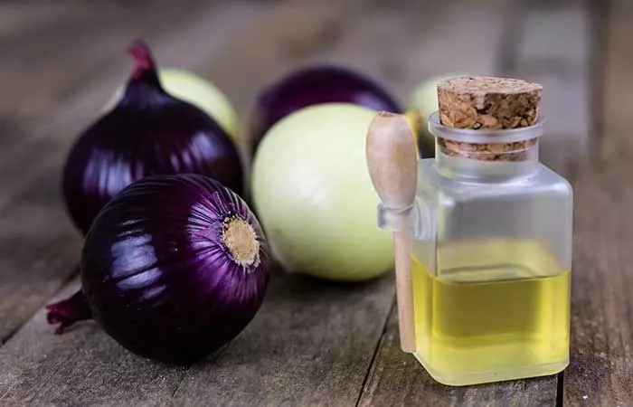 Onion juice can treat dandruff