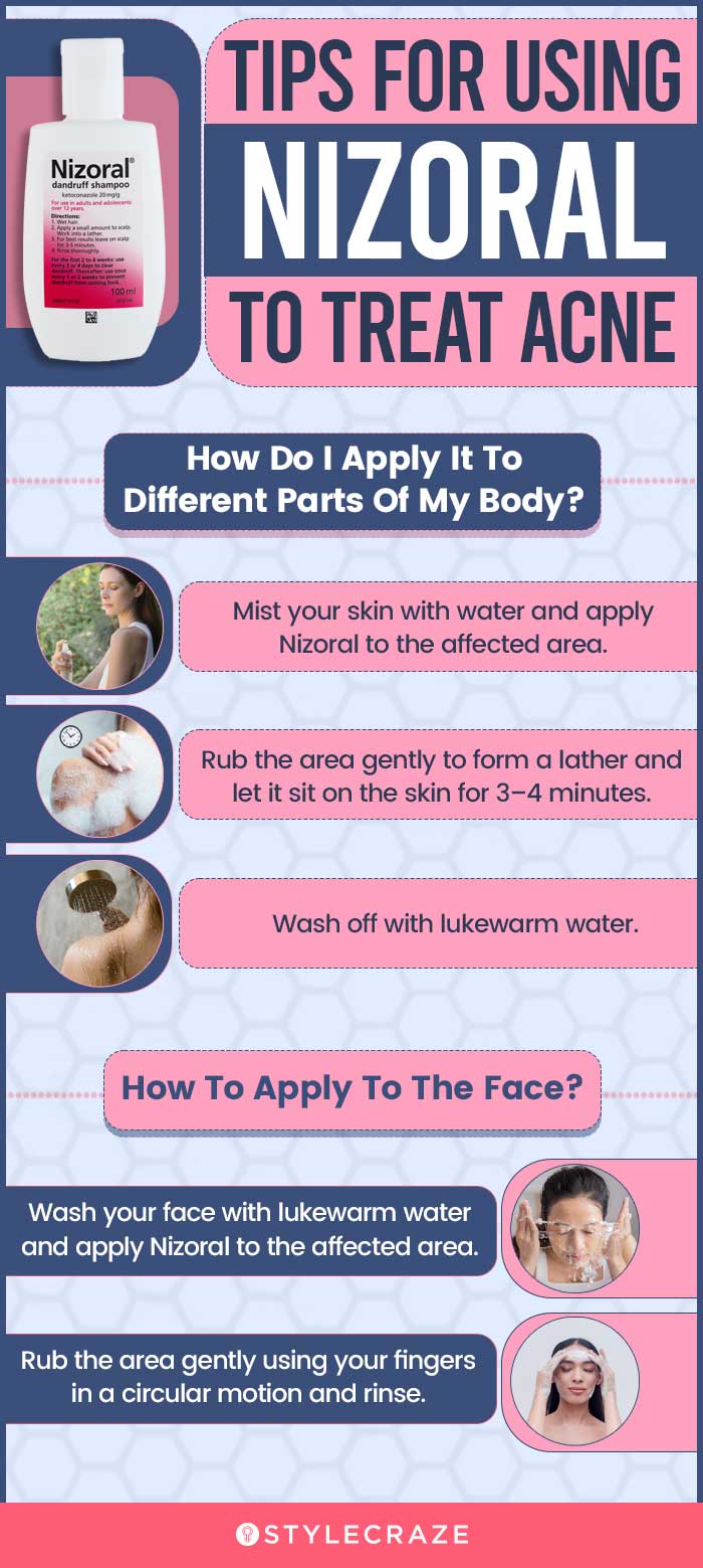 tips for using nizoral to treat acne (infographic)