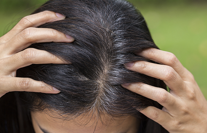 Woman Facing Premature Hair Graying