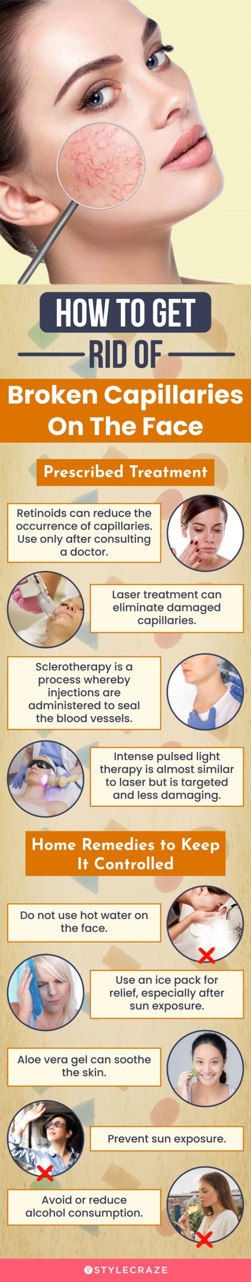 how to get rid of broken capillaries on face (infographic)
