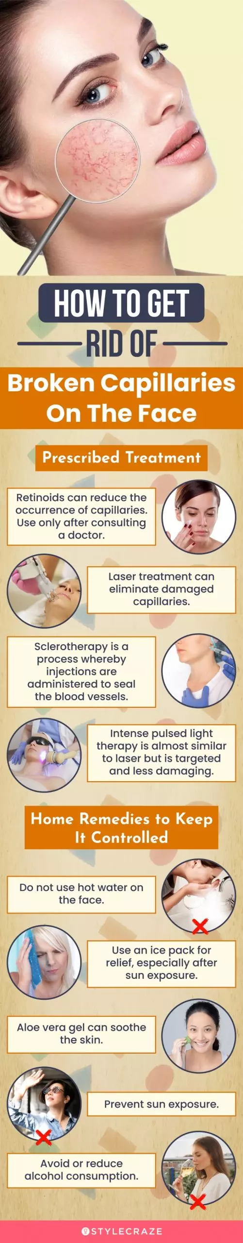 how to get rid of broken capillaries on face (infographic)