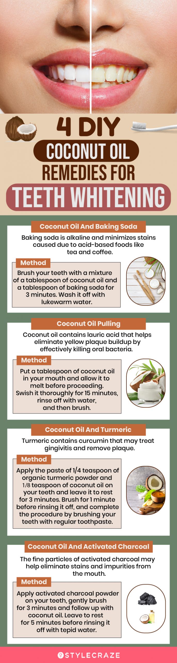 4 diy coconut oil remedies for teeth whitening (infographic)