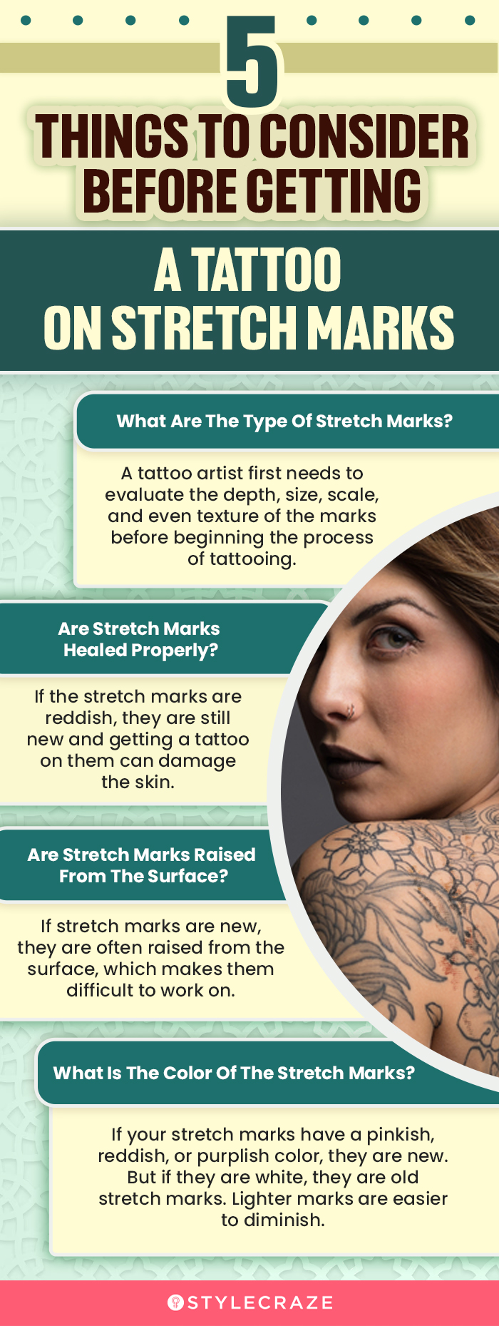 5 things to consider before getting a tattoo on stretch marks (infographic)