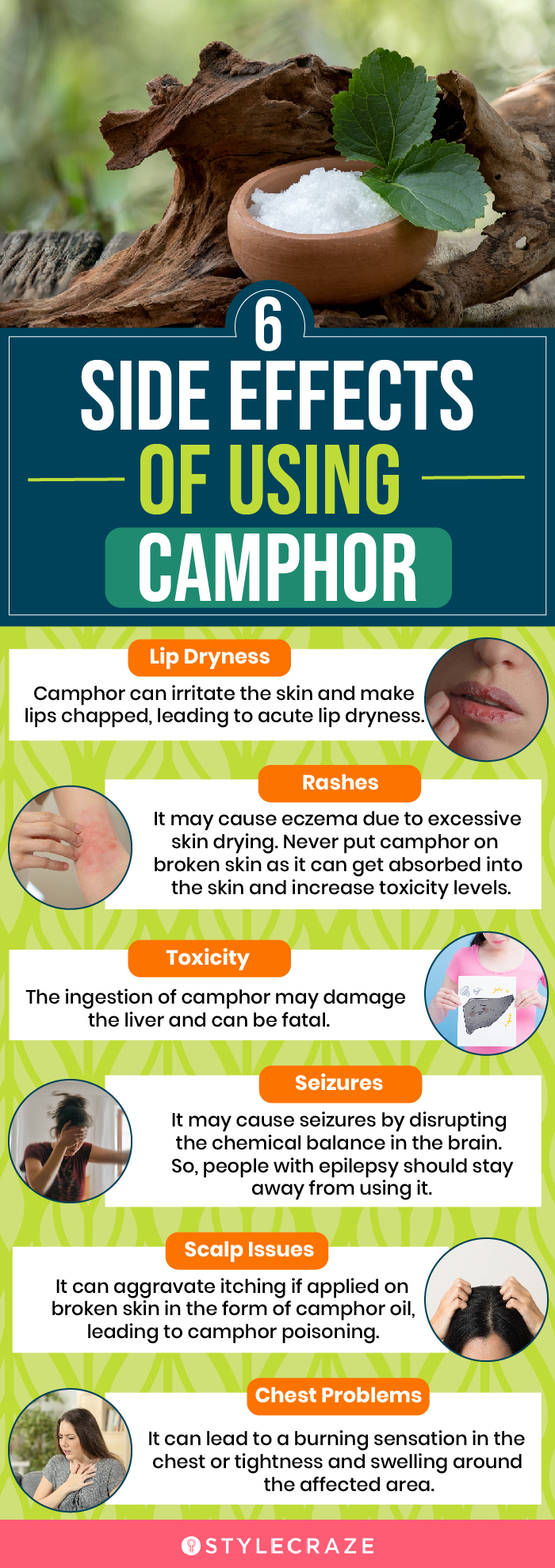 6 side effects of using camphor (infographic)