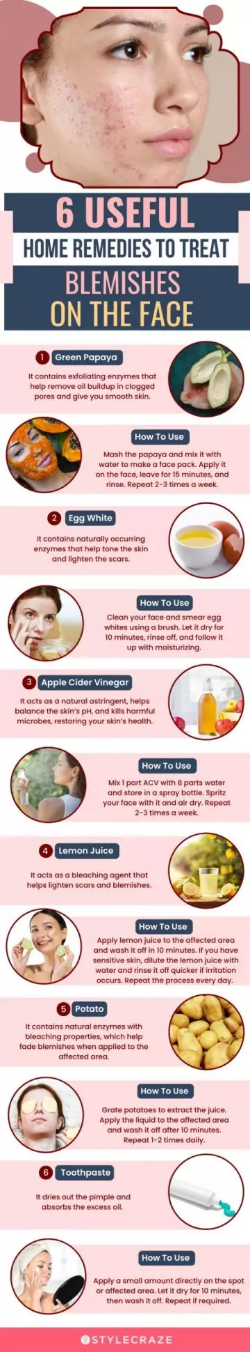 6 useful home remedies to treat blemishes oh the face (infographic)
