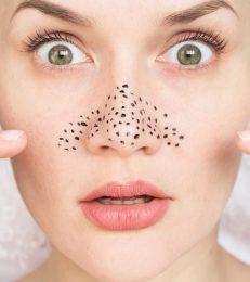 7 Surprisingly Common Things That Could Clog Your Pores And Cause Acne