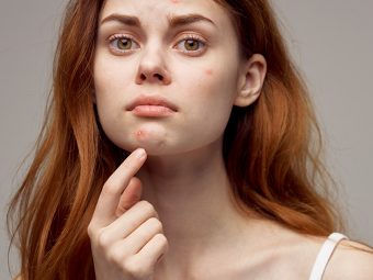 8 Things That Are Causing Acne On Every Part Of Your Face