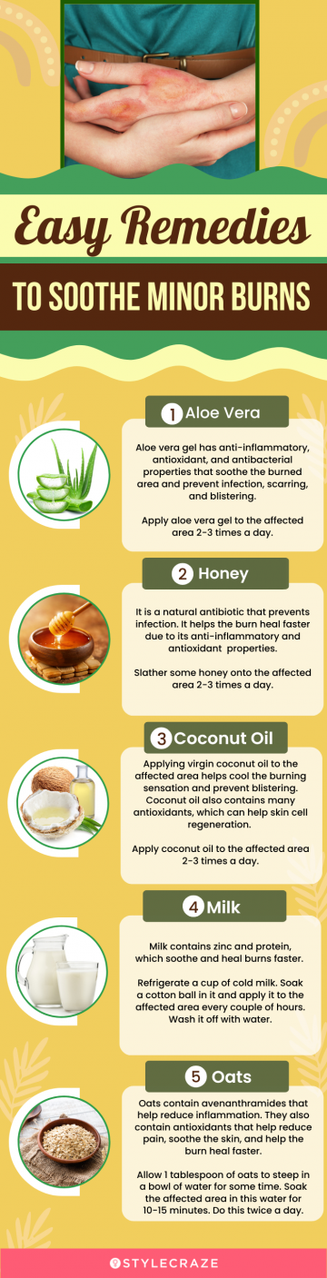easy remedies to soothe minor burns at home (infographic)