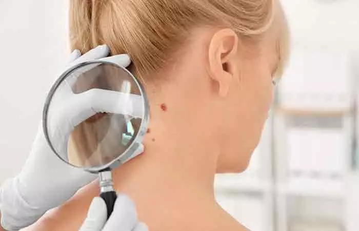 It-May-Cause-Skin-Cancer