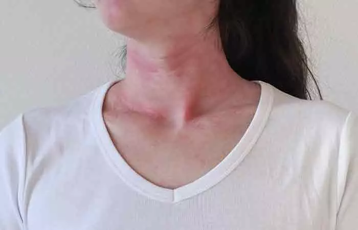 It-May-Lead-To-Allergic-Reactions