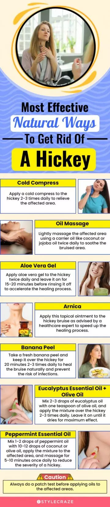 most effective natural ways to get rid of a hickey (infographic)