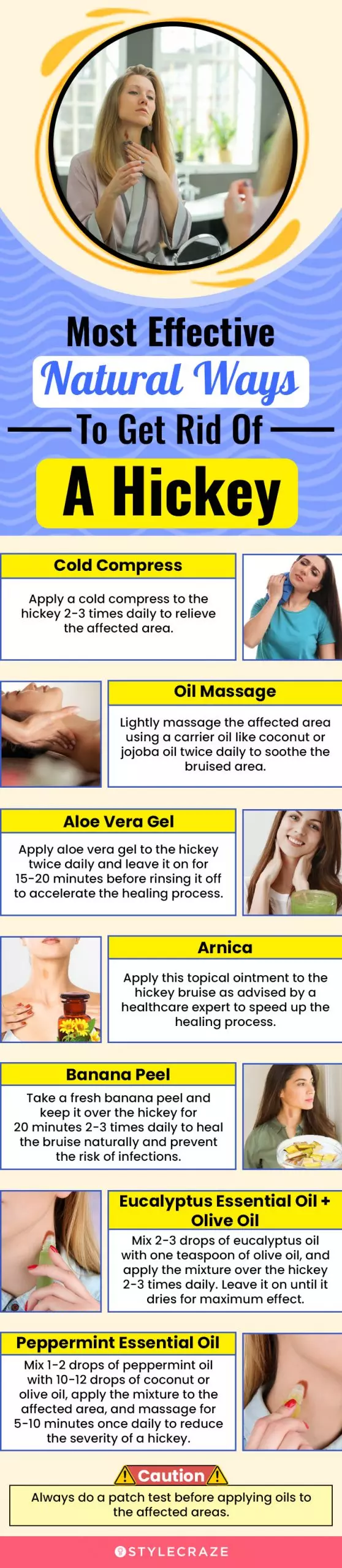 most effective natural ways to get rid of a hickey (infographic)