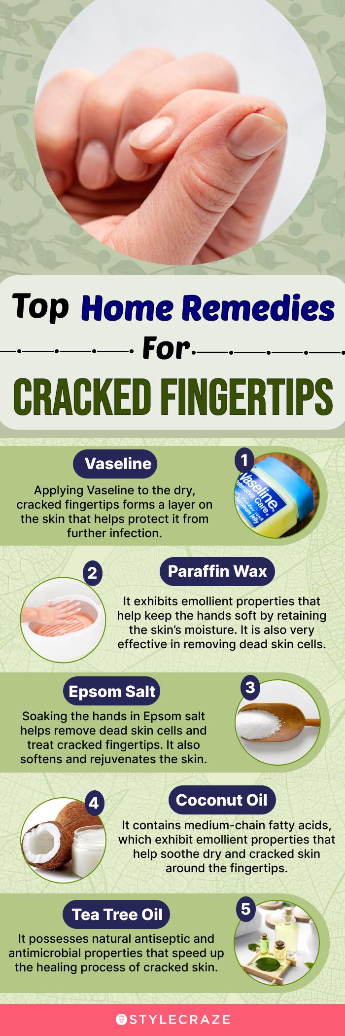 top home remedies for cracked fingertips (infographic)