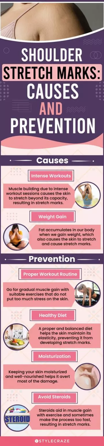 shoulder stretch marks causes and prevention (infographic)