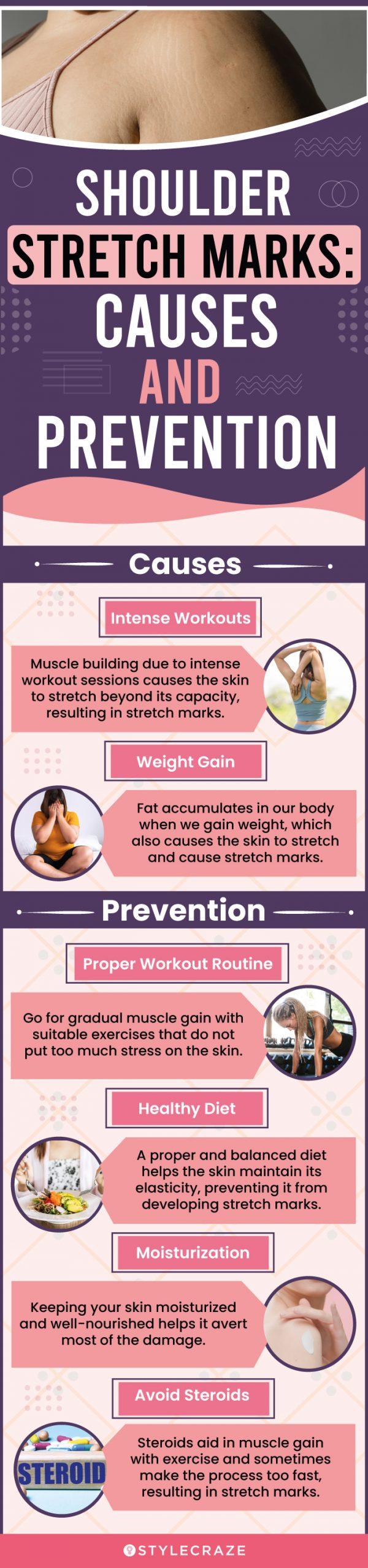 shoulder stretch marks causes and prevention (infographic)