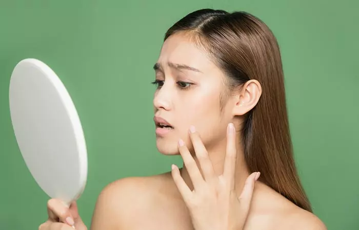 Sugar Doesn't Cause Breakouts