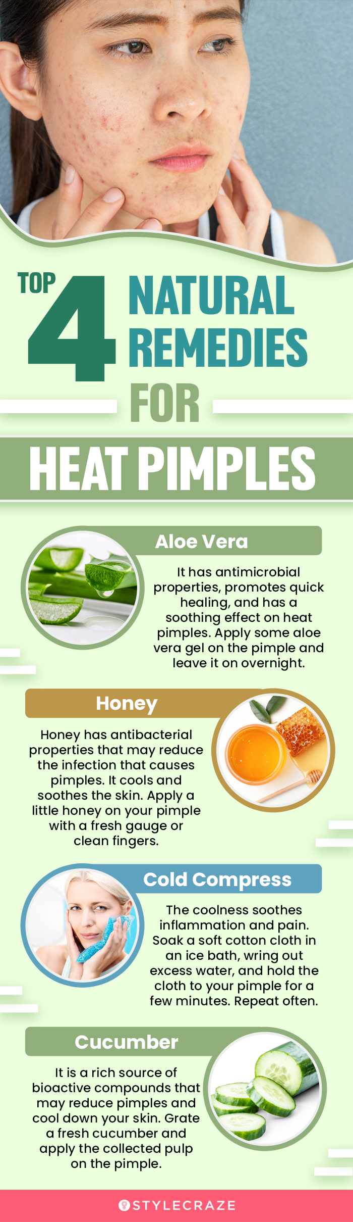 top 4 natural remedies for heat pimples (infographic)