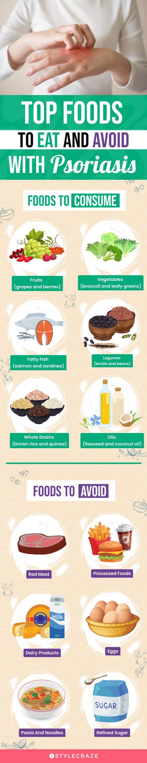 top foods to eat and avoid with psoriasis (infographic)