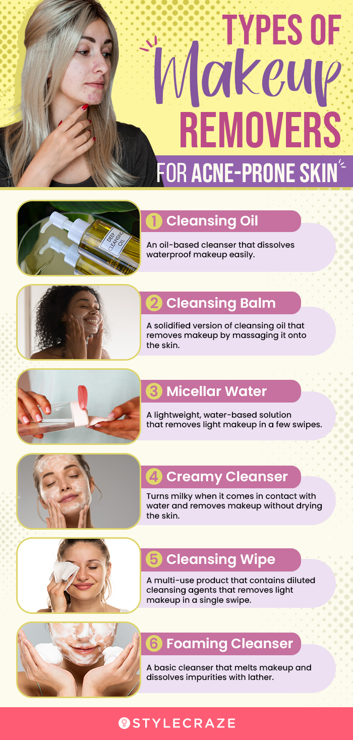 Types Of Makeup Removers For Acne-Prone Skin (infographic)