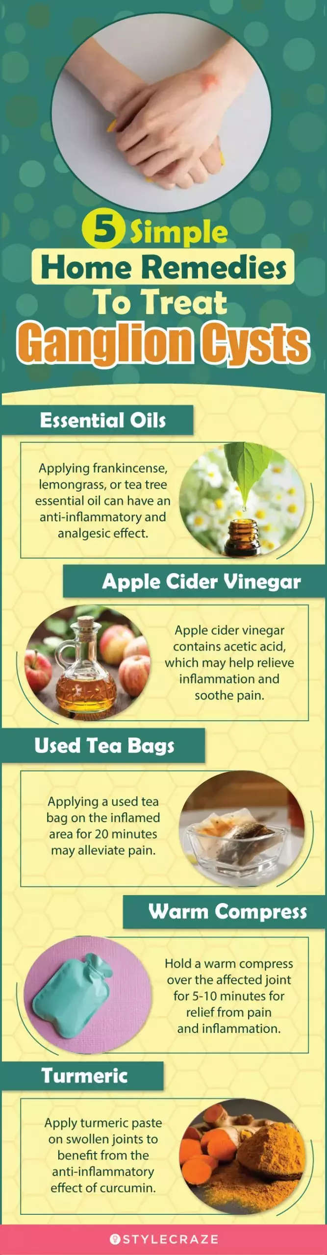 5 simple home remedies to treat ganglion cysts (infographic)