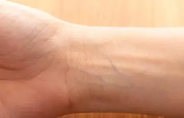 Check The Color Of Your Veins