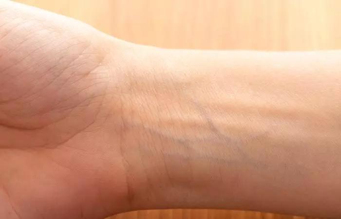 Check The Color Of Your Veins
