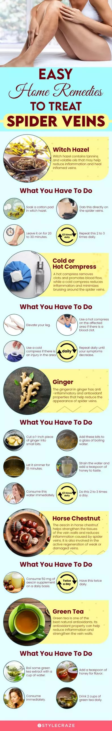 easy home remedies to treat spider veins (infographic)