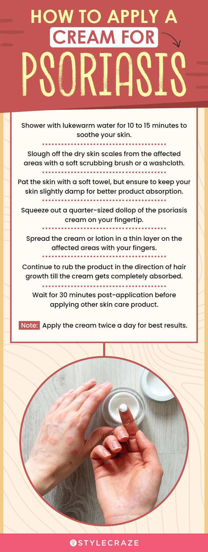 How To Apply A Cream For Psoriasis (infographic)