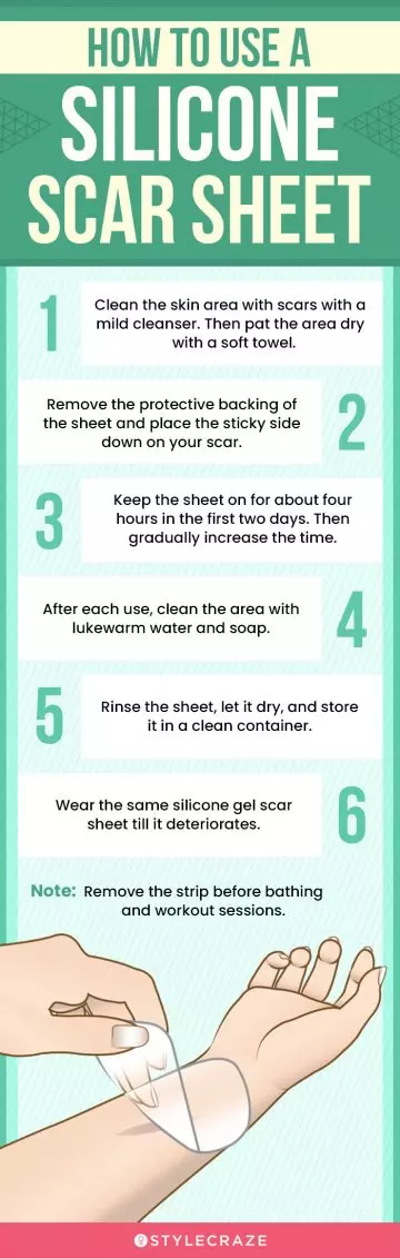 How To Use A Silicone Scar Sheet (infographic)