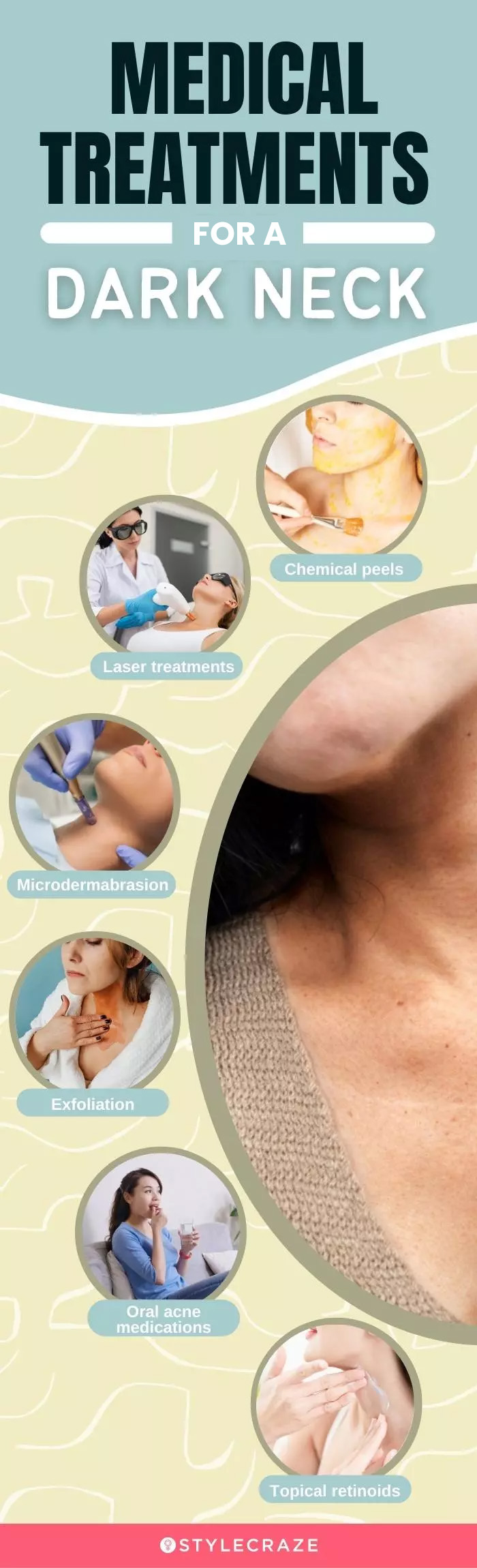 medical treatments for dark neck (infographic)