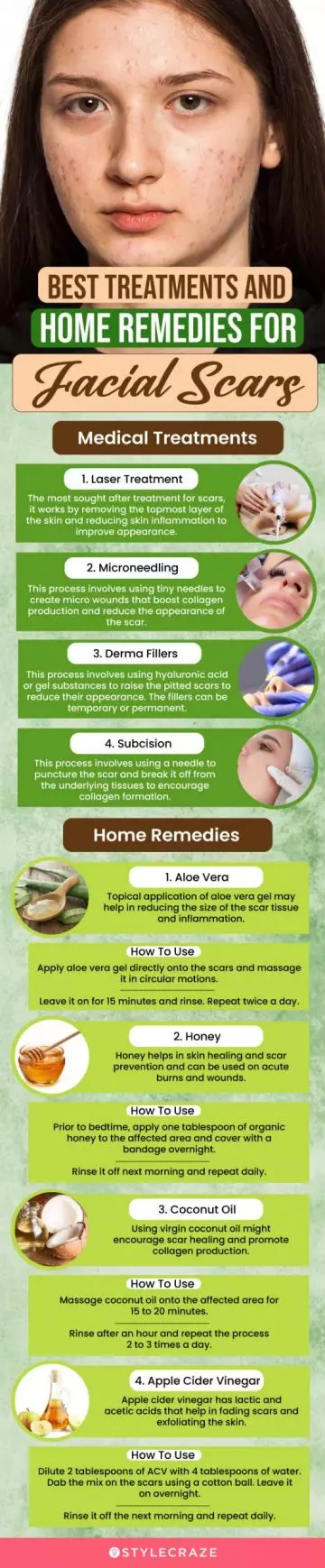 best treatments and home remedies for facial scars (infographic) 