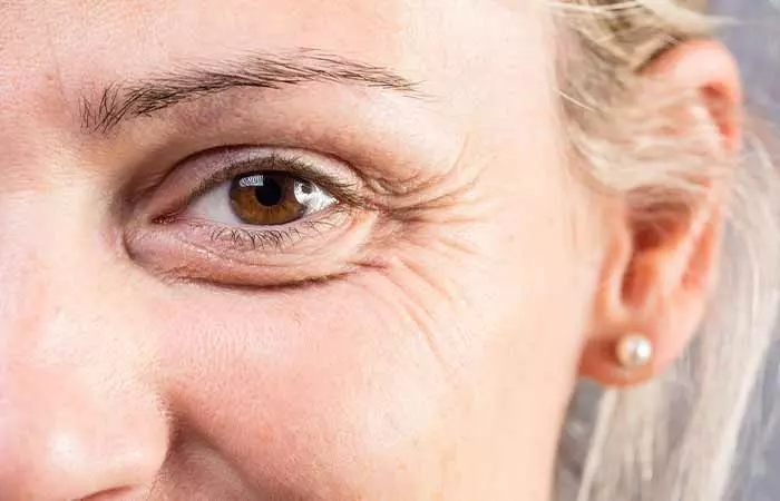 Wrinkles