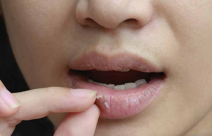 Your-Lip-Skin-May-Dry-Out