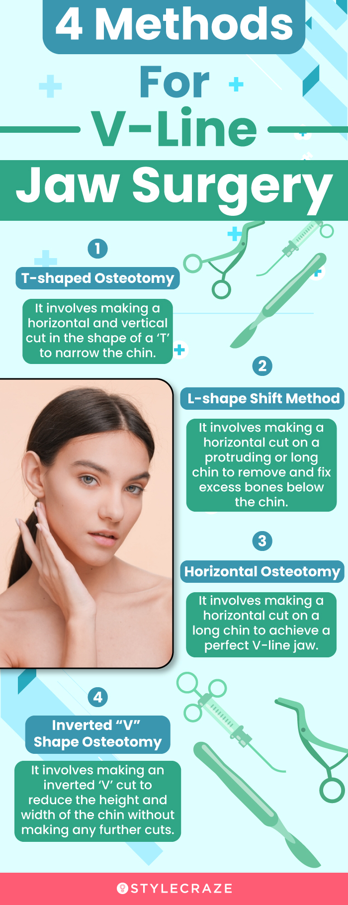 4 methods for vline jaw surgery (infographic)
