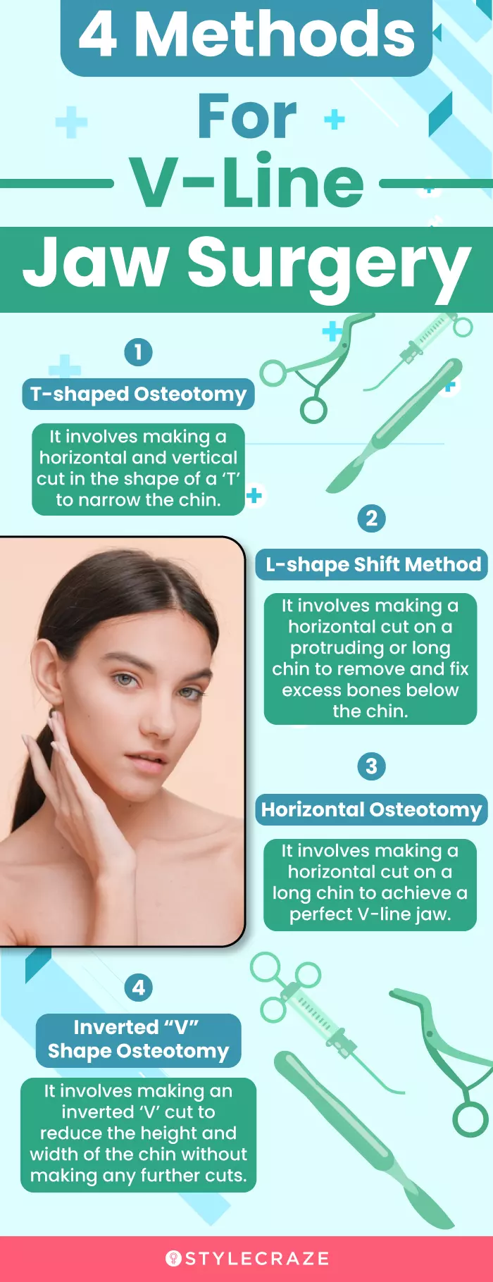 4 methods for vline jaw surgery (infographic)