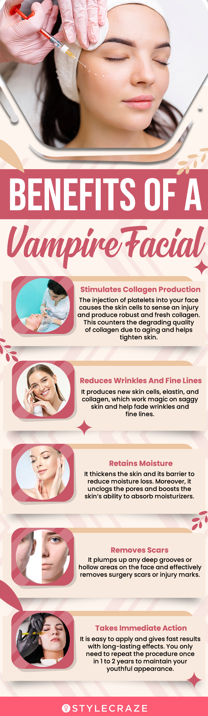 benefits of a vampire facial (infographic)