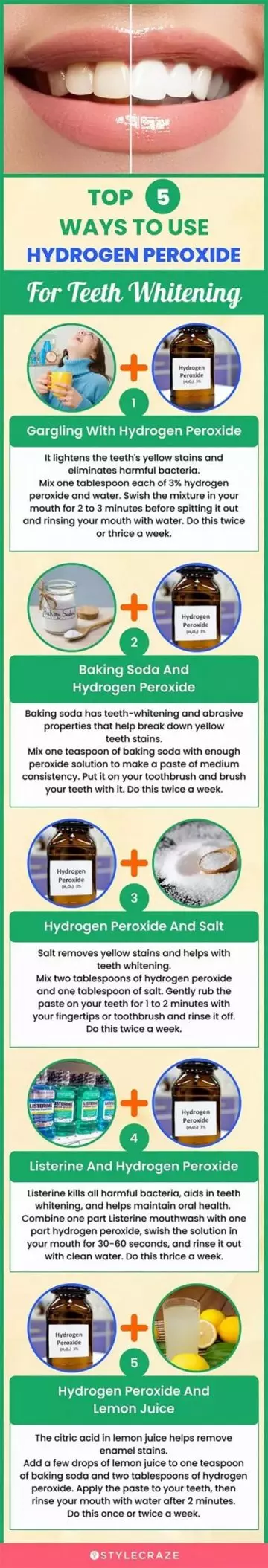 top 5 ways to use hydrogen peroxide for teeth whitening (infographic)