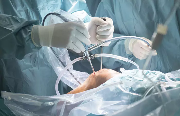 Surgical Interventions