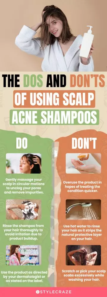 Using Scalp Acne Shampoos (infographic)