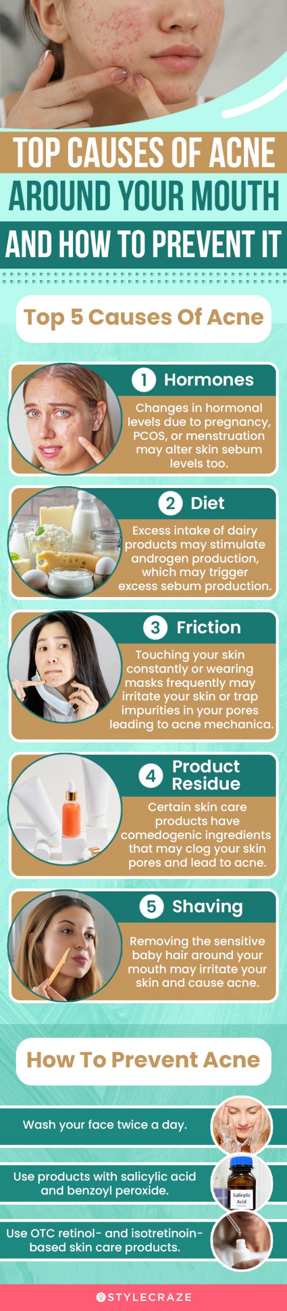 top causes of acne around your mouth and how to prevent it(infographic)