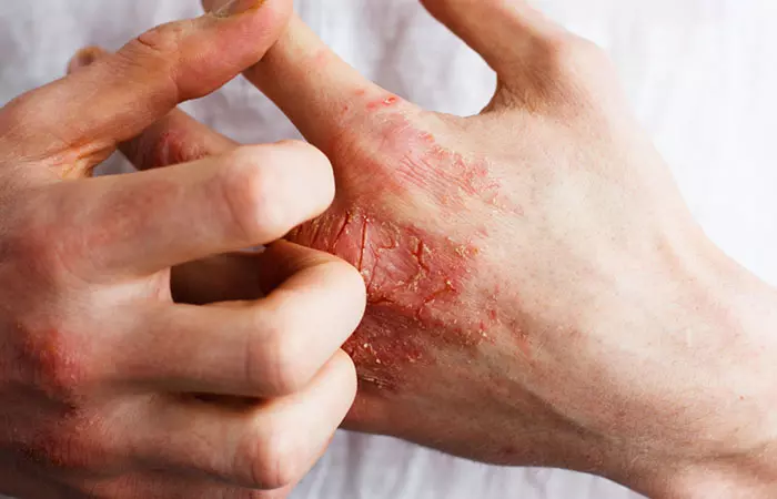 Underlying Skin Conditions