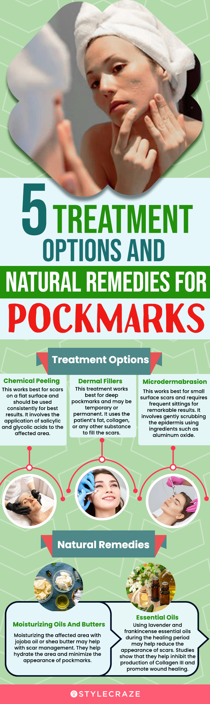 5 treatment options and natural remedies for pockmarks (infographic)