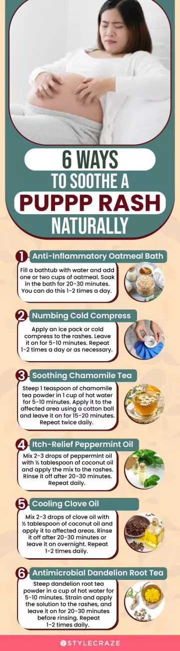 6 ways to soothe a puppp rash naturally (infographic)