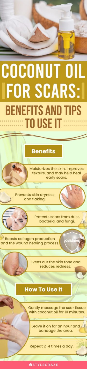 coconut oil for scars: benefits and tips to use it (infographic)