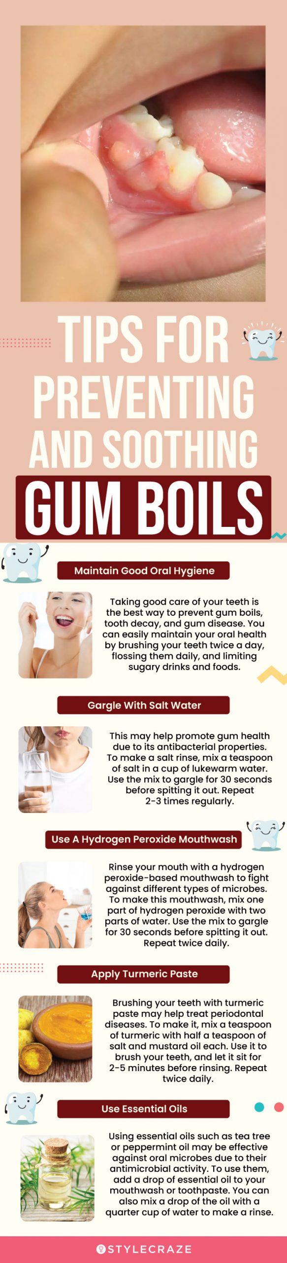 tips for preventing and soothing gum boil (infographic)