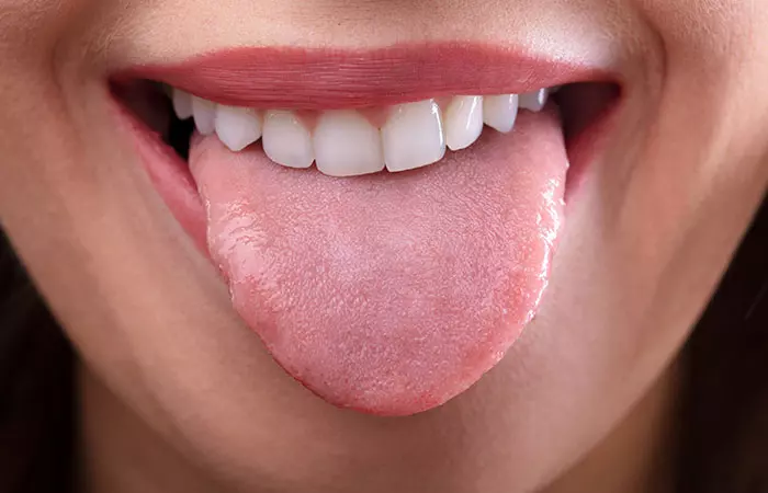 Tongue